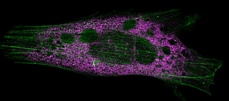 Two-colour fluorescence image of a cell