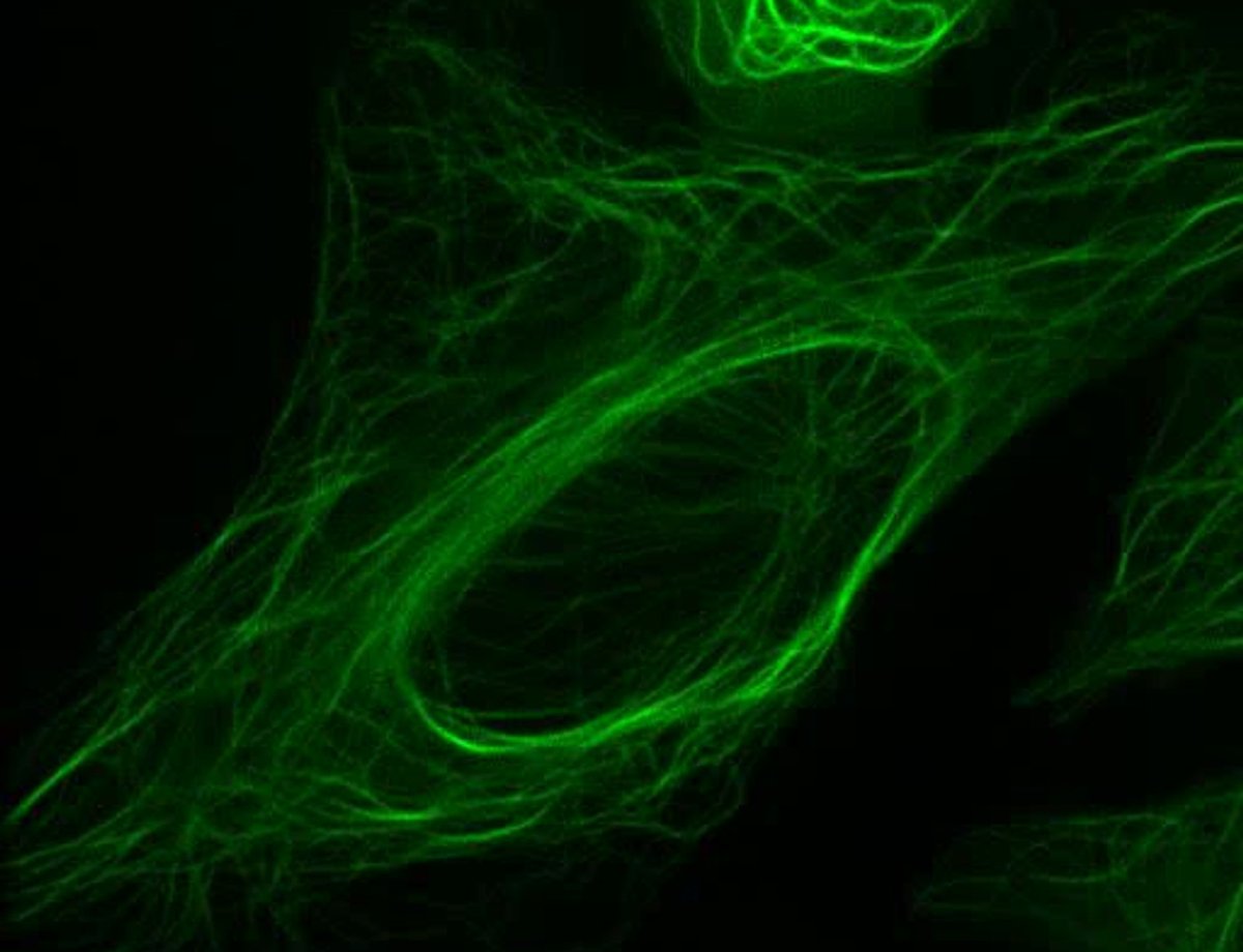 Fluorescence micrograph of the cytoskeleton in a live cell