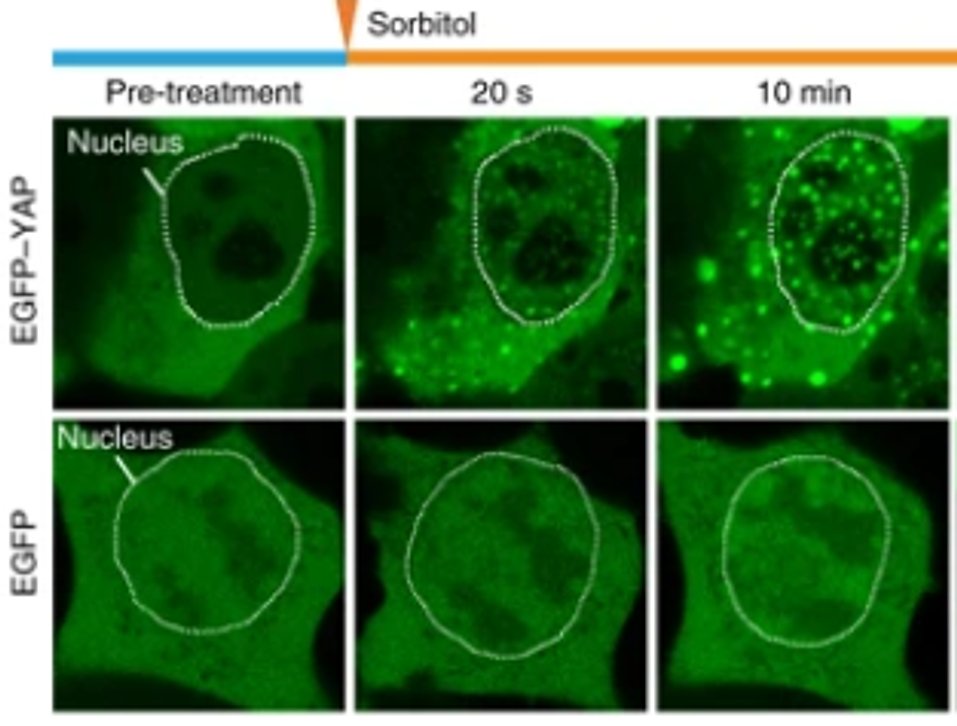 Live-cell imaging of EGFP-YAP condensate formation after sorbitol treatment